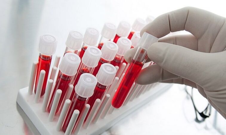 blood in test tubes for the analysis of a dog with prostatitis