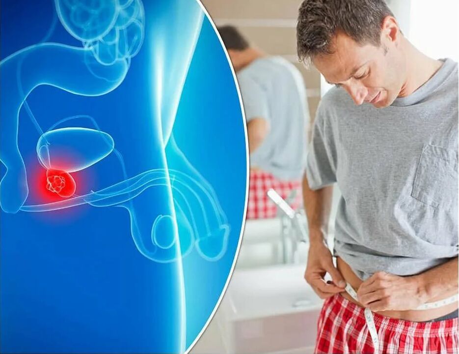 symptoms and causes of prostatitis